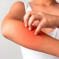 Для кожи (дерматит, псориаз, аллергия) - Оздоровительно-профилактические программы